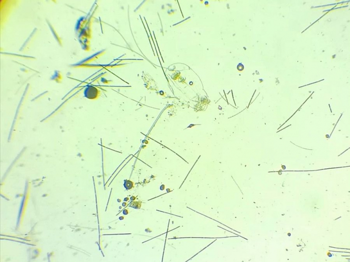 Baggersee_Juli-2026_-_Plankton__Foto_TMG