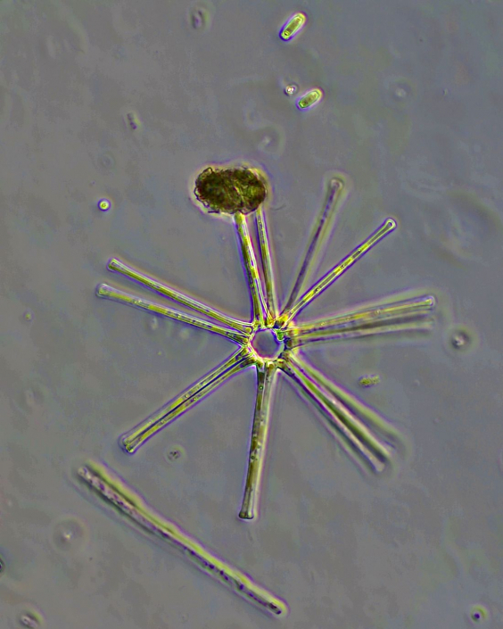 Asterionella_formosa_01