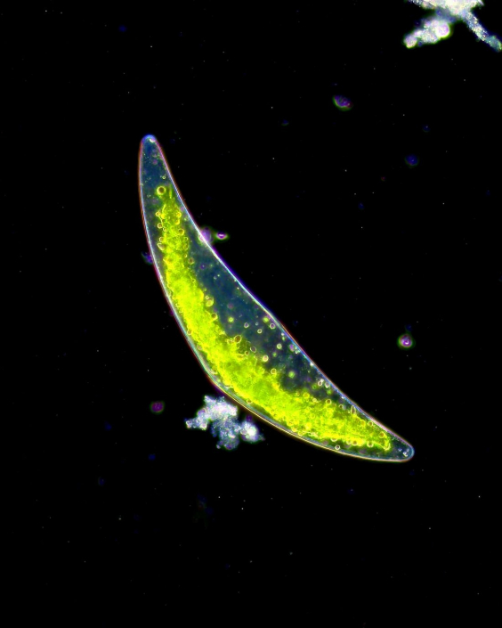 Closterium_01