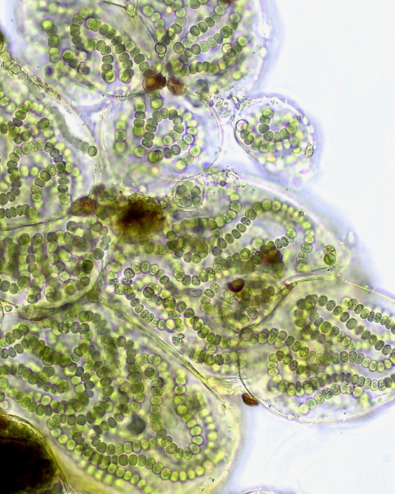 Cyanobakterien_01