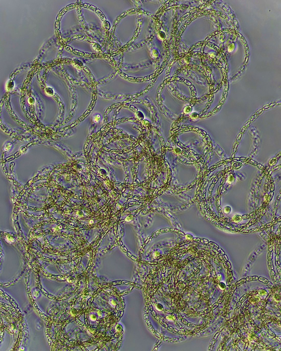 Cyanobakterien_trichal_01