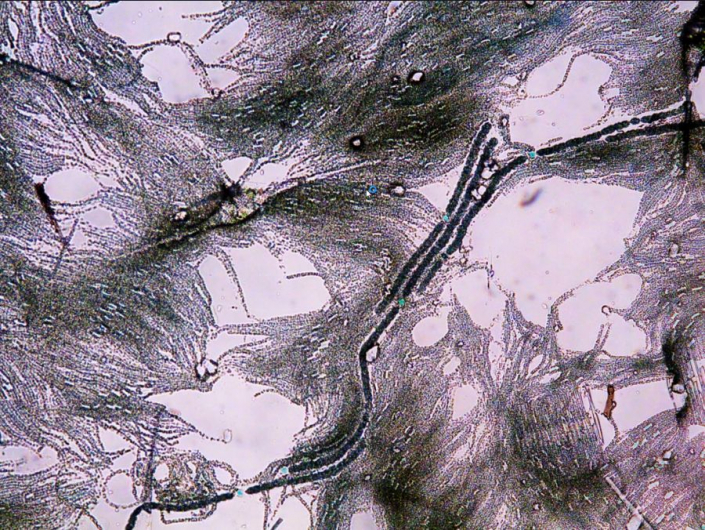 Eingetrocknete Planktonprobe mit Blaualgen (Foto TMG)