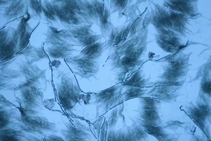 Eingetrocknete Planktonprobe mit Blaualgen (Foto TMG)