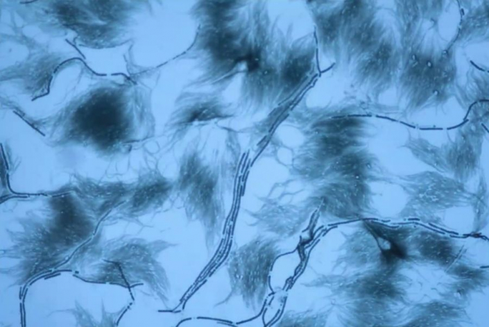 Eingetrocknete Planktonprobe mit Blaualgen (Foto TMG)