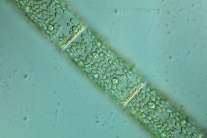 Grünalge mit Pyrenoiden (Foto Igor Reicher)