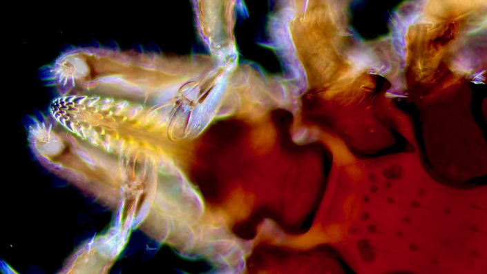 Ixodes_ricinus_02
